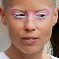 Pfostenbild