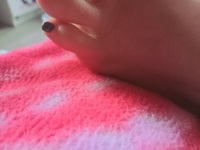 Pfostenbild