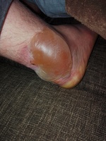 Pfostenbild