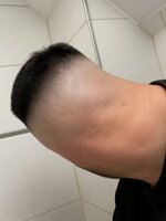 Pfostenbild